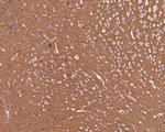 GNB1 Antibody in Immunohistochemistry (Paraffin) (IHC (P))