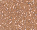 GNB1 Antibody in Immunohistochemistry (Paraffin) (IHC (P))