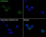 PPP2R1B Antibody in Immunocytochemistry (ICC/IF)