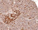 PPP2R1B Antibody in Immunohistochemistry (Paraffin) (IHC (P))