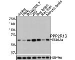 PPP2R1B Antibody in Western Blot (WB)