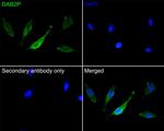 DAB2IP Antibody in Immunocytochemistry (ICC/IF)