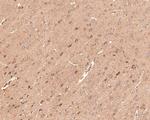 IRAK1 Antibody in Immunohistochemistry (Paraffin) (IHC (P))