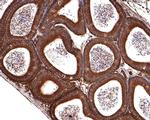 14-3-3 zeta Antibody in Immunohistochemistry (Paraffin) (IHC (P))