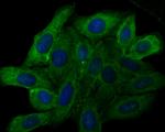 TRPV6 Antibody in Immunocytochemistry (ICC/IF)