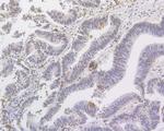 MED12 Antibody in Immunohistochemistry (Paraffin) (IHC (P))