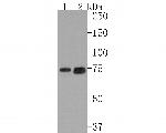 TCCR Antibody in Western Blot (WB)