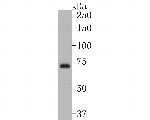 TCCR Antibody in Western Blot (WB)