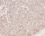 beta-1,2 Adaptin Antibody in Immunohistochemistry (Paraffin) (IHC (P))