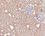 beta-1,2 Adaptin Antibody in Immunohistochemistry (Paraffin) (IHC (P))