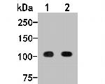 beta-1,2 Adaptin Antibody in Western Blot (WB)