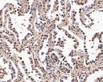 BRG1 Antibody in Immunohistochemistry (Paraffin) (IHC (P))