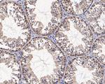 BRG1 Antibody in Immunohistochemistry (Paraffin) (IHC (P))