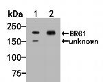 BRG1 Antibody in Western Blot (WB)