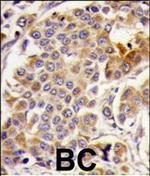 AMPK alpha-1 Antibody in Immunohistochemistry (Paraffin) (IHC (P))