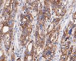 Claudin 18 Antibody in Immunohistochemistry (Paraffin) (IHC (P))