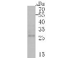 Claudin 18 Antibody in Western Blot (WB)