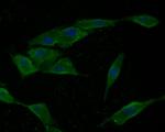 RhoGDI Antibody in Immunocytochemistry (ICC/IF)