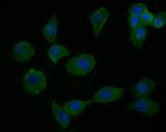 cGAS Antibody in Immunocytochemistry (ICC/IF)