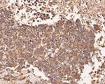 beta Galactosidase Antibody in Immunohistochemistry (Paraffin) (IHC (P))