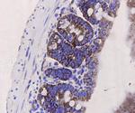 PUMA alpha/beta Antibody in Immunohistochemistry (Paraffin) (IHC (P))