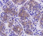 Caspase 3 Antibody in Immunohistochemistry (Paraffin) (IHC (P))