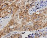 VEGF Antibody in Immunohistochemistry (Paraffin) (IHC (P))