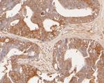 GADD34 Antibody in Immunohistochemistry (Paraffin) (IHC (P))