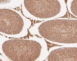 Connexin 26 Antibody in Immunohistochemistry (Paraffin) (IHC (P))