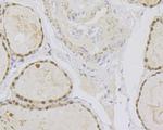 PAX8 Antibody in Immunohistochemistry (Paraffin) (IHC (P))