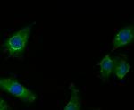 RIP3 Antibody in Immunocytochemistry (ICC/IF)