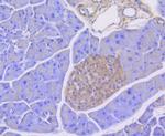 RIP3 Antibody in Immunohistochemistry (Paraffin) (IHC (P))