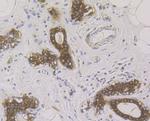 Cytokeratin 19 Antibody in Immunohistochemistry (Paraffin) (IHC (P))