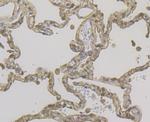 Cytokeratin 19 Antibody in Immunohistochemistry (Paraffin) (IHC (P))