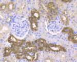 Cytokeratin 19 Antibody in Immunohistochemistry (Paraffin) (IHC (P))