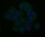 IP3 Receptor 2 Antibody in Immunocytochemistry (ICC/IF)