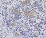 IP3 Receptor 2 Antibody in Immunohistochemistry (Paraffin) (IHC (P))