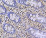 IP3 Receptor 2 Antibody in Immunohistochemistry (Paraffin) (IHC (P))