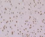 Histone Macro-H2A.1 Antibody in Immunohistochemistry (Paraffin) (IHC (P))