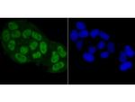 BUBR1 Antibody in Immunocytochemistry (ICC/IF)