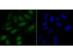 BUBR1 Antibody in Immunocytochemistry (ICC/IF)