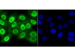 APE1 Antibody in Immunocytochemistry (ICC/IF)