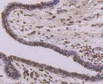 APE1 Antibody in Immunohistochemistry (Paraffin) (IHC (P))