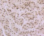 APE1 Antibody in Immunohistochemistry (Paraffin) (IHC (P))