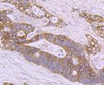 SHP2 Antibody in Immunohistochemistry (Paraffin) (IHC (P))