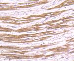 SHP2 Antibody in Immunohistochemistry (Paraffin) (IHC (P))