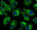 Cytokeratin 8 Antibody in Immunocytochemistry (ICC/IF)