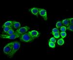 Cytokeratin 8 Antibody in Immunocytochemistry (ICC/IF)