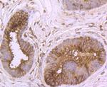 Cytokeratin 8 Antibody in Immunohistochemistry (Paraffin) (IHC (P))