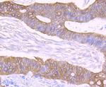 Cytokeratin 8 Antibody in Immunohistochemistry (Paraffin) (IHC (P))